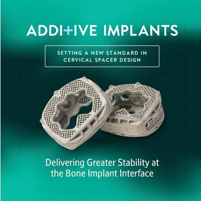 Additive Implant