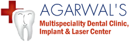 Ahmedabad Dental Implant